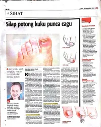Clipping: Silap potong kuku punca cagu